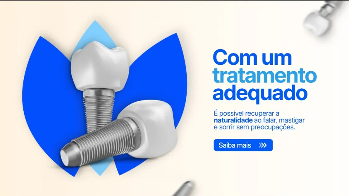 Implantes